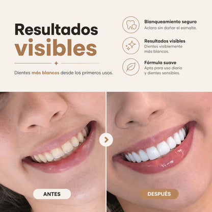Sereno White™ – Blanquea tus dientes desde casa en 10–15 minutos al día