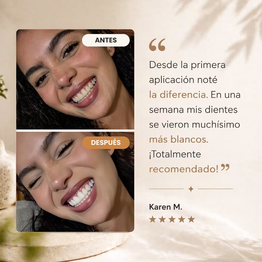 Sereno White™ – Blanquea tus dientes desde casa en 10–15 minutos al día