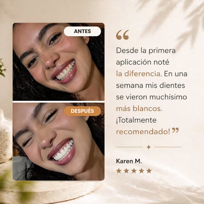 Sereno White™ – Blanquea tus dientes desde casa en 10–15 minutos al día